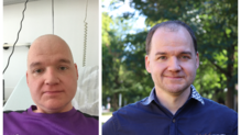 Vorher und nachher: Markus Hilser aus Lauterbach im Landkreis Rottweil im Mai 2020 während seiner Chemotherapie (links). Heute ist er ...