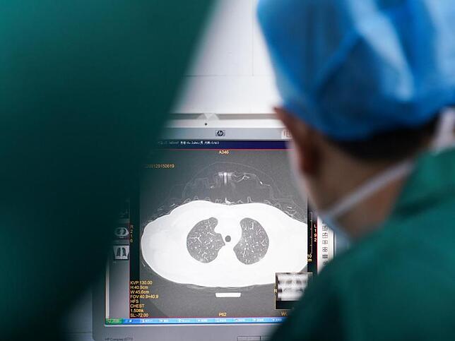 Untersuchung Ein Arzt überprüft das CT-Bild der Lunge eines Patienten in einem Krankenhaus in Zhangzhou.