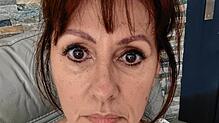 Die Französin Véronique Scheins kam bei einem Routineeingriff durch einen deutschen Arzt beinahe ums Leben und leidet auch Jahre danach ...