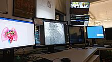 Im Herzkatheterlabor des Klinikums Hochrhein in Waldshut steckt viel Technik (Archivbild). Was passiert, wenn die digitale Infrastruktur ...
