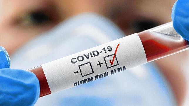 Im Zollernalbkreis sind insgesamt elf Personen mit dem Coronavirus infiziert. Das ist der Stand am Montagnachmittag.