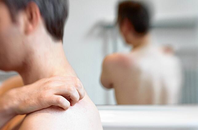 Hautbläschen und Juckreiz sind typische Symptome der Gürtelrose. Die Erkrankung kann aber auch chronische Nervenschmerzen verursachen.