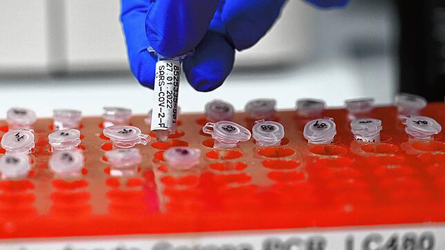 Eine Mitarbeiterin eines PCR Testlabors bereitet PCR Tests vor.