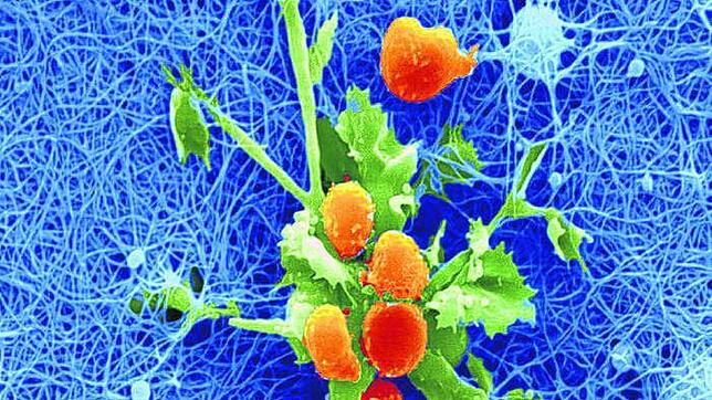 Live aus der Maus: Erstmals in Europa sind Forschern Aufnahmen im Lymphknoten einer lebenden Maus gelungen. Das Bild zeigt Immunzellen ...