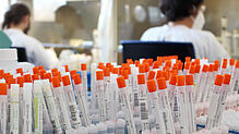 Im MVZ Labor Ravensburg werden wöchentlich aktuell rund 35.000 Proben per PCR-Diagnose auf das Coronavirus untersucht. Damit sind die ...