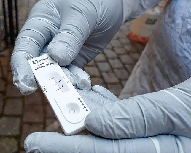Zwei Streifen &ndash; so würde ein positives Testergebnis aussehen. Das Testergebnis wurde durch nicht-infektiöses Material simuliert.