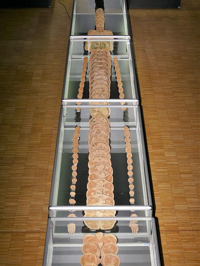 Anatomische Vorlage: Der Mensch in Scheibenform &ndash; zu sehen derzeit in der Talwiesenhalle.