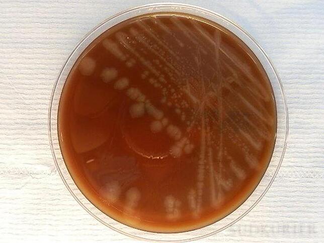 Fester Nährboden mit Campylobacter-Kolonien.