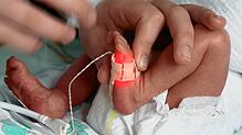 ARCHIV – Wenn Kliniken frühgeborene Kinder versorgen möchten, müssen sie eine Mindestanzahl von Patienten aufweisen. Dagegen haben drei ...