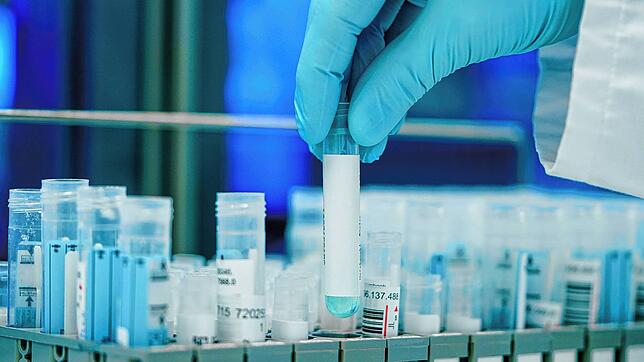 PCR-Tests werden in einem Labor ausgewertet &ndash; Deutschland hat hier im europaweiten Vergleich deutlich geringere Kapazitäten.